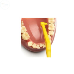 TEPE ARAYUZ ANGLE SARI 0.7 MM - 3